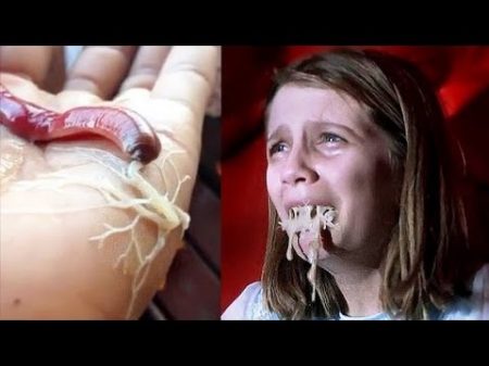 8 УЖАСНЫХ ВЕЩЕЙ НАЙДЕННЫХ В ТЕЛЕ ЧЕЛОВЕКА
