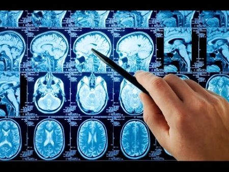 МРТ головного мозга ответы на самые частые вопросы