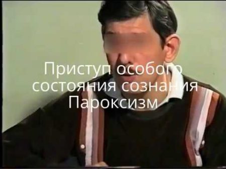 Приступ особого состояния сознания Пароксизм Fits Special state of consciousness