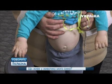 Что живет в животике моего сына полный выпуск Говорить Україна