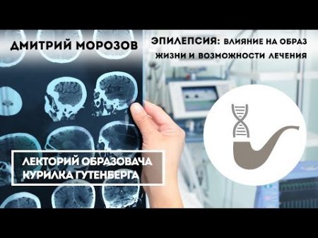 Дмитрий Морозов Эпилепсия влияние на образ жизни и возможности лечения