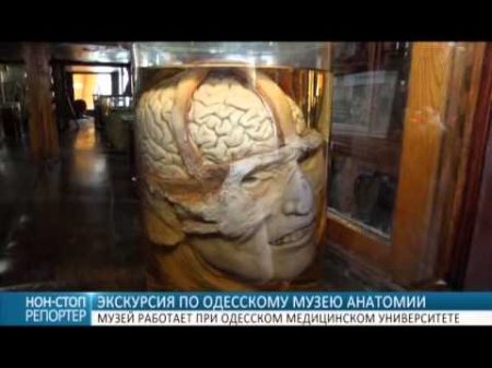 Экскурсия по Одесскому музею анатомии скелеты черепа органы и эмбрионы
