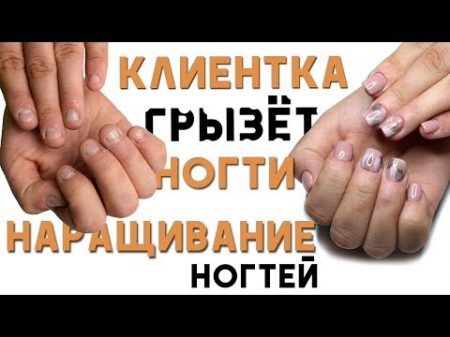 ОБКУСАННЫЕ ногти преображение Наращиваем ногти Грызуна