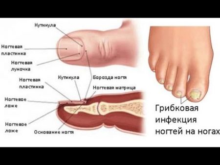 Доктор Уваи дов Грибок на ногтях Лечение грибка ногтеи