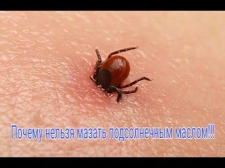 Как вытащить клеща! Как быстро вытащить клеща из тела человека How to pull the tick!