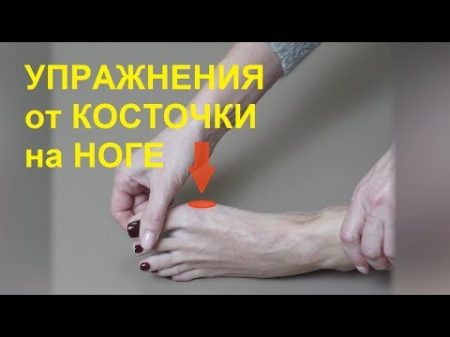 Упражнения от косточки на ноге гимнастика для лечения большого пальца ноги