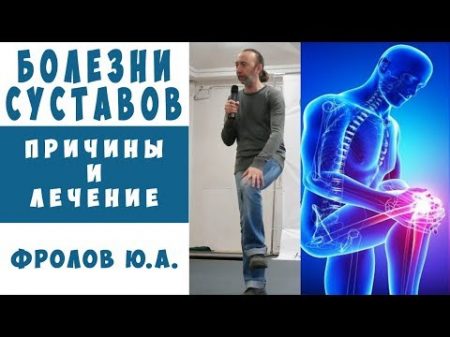 Артриты Артрозы Лечение Суставов быстро и надёжно навсегда Фролова Ю А