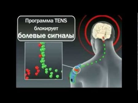 Принцип работы миостимуляторов