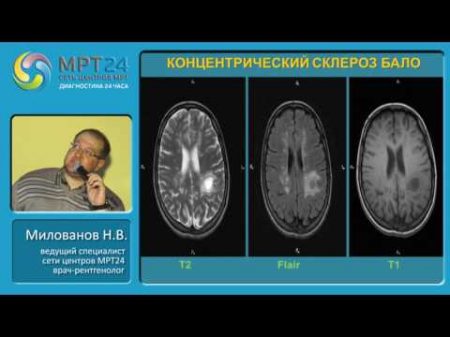 Дифференциальная диагностика очаговых и объемных изменений головного мозга