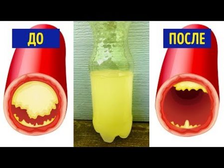 15 Продуктов Которые Снижают Риск Сердечного Приступа