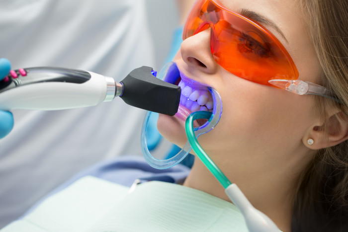 Зачем делать процедуру отбеливания зубов